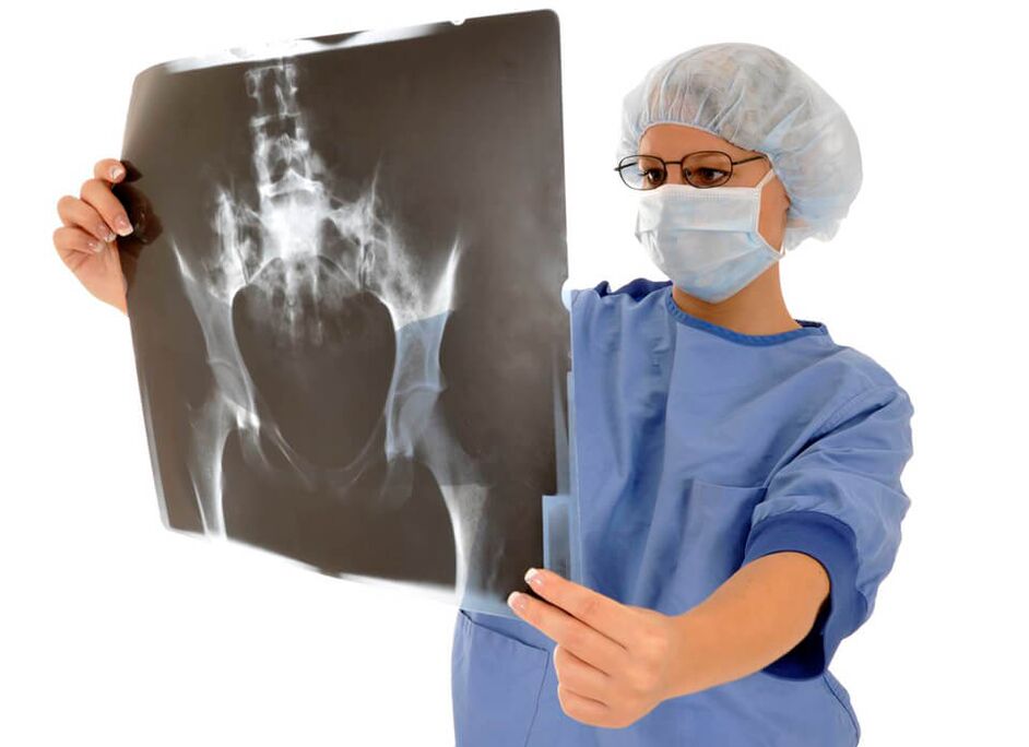 X-ray of the hip joint will help the doctor determine the cause of pain