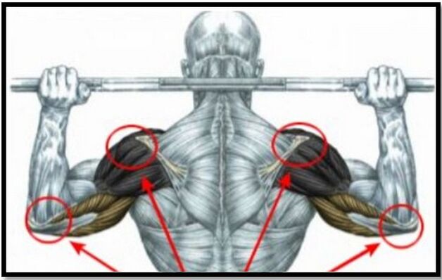 The load on the muscles of the shoulder and elbow is one of the causes of arthrosis of the shoulder joint