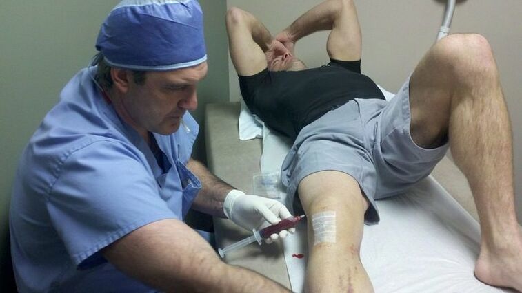 Arthrosis of the knee joint