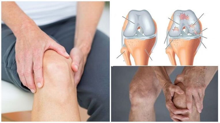 Knee -pain symptom